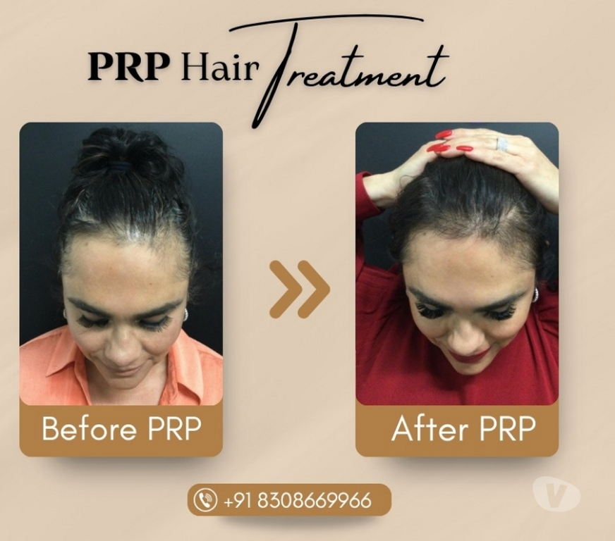 Well-being services Pune - Photos for Trusted Skin Specialist in Kondhwa – Book Your Appointment