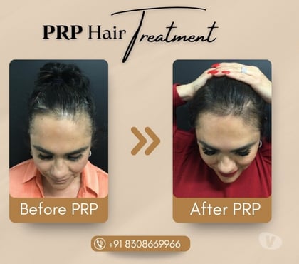 Health & Well-Being - Photos for Trusted Skin Specialist in Kondhwa – Book Your Appointment