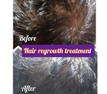 Get Flawless Skin with LOOK n SHAPE SKIN & HAIR CARE CLINIQ